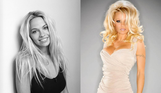 Worst celebrity plastic surgery fails