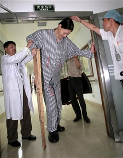 Yao Defeng, widely considered as Asia's tallest woman, is helped past a doorway at a hospital in Shanghai Wednesday June 14, 2006. At 2.36-meters (7.74 feet) tall the 34-year-old Yao is 0.1 meter (3.9 inches) taller than the famous NBA star Yao Ming, who is unrelated to her. According to a Chinese website, Yao Defeng is undergoing checks to see if surgery can be performed to remove a benign brain tumour that is causing her gigantism. Yao is suffering complications from high blood pressure, acromegaly, osteoporosis and malnutrition due to the excess growth hormones.[AP]