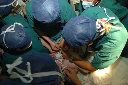 ,,,conjoined twins,,,