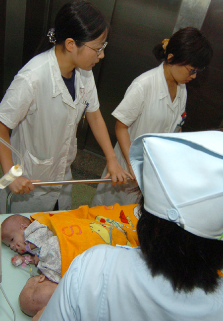 ,,,conjoined twins,,,