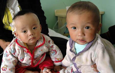 Two babies with kidney stones receive medical treatment at a military hospital in Lanzhou, capital of northwest China's Gansu Province, Sept. 11, 2008. 