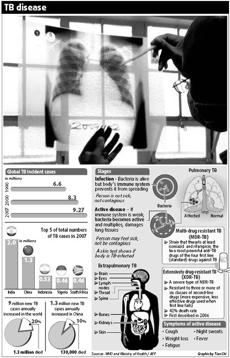 WHO: Act now or risk a fatal TB outbreak