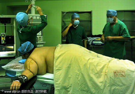 Overweighted woman receives surgical treatment
