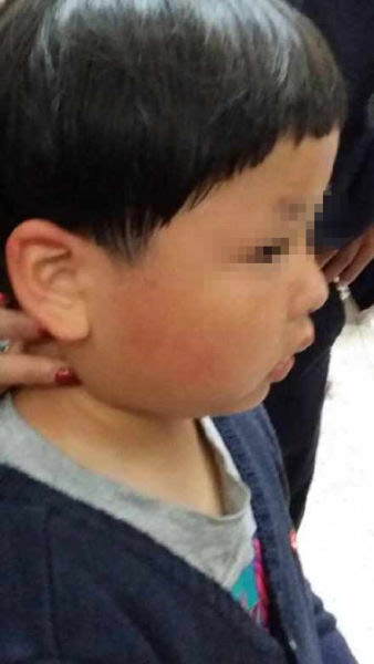 Foreign woman detained for slapping boy, 6