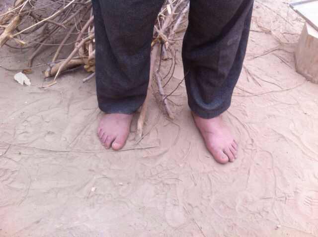 Campaign to save the soles of big-footed farmer
