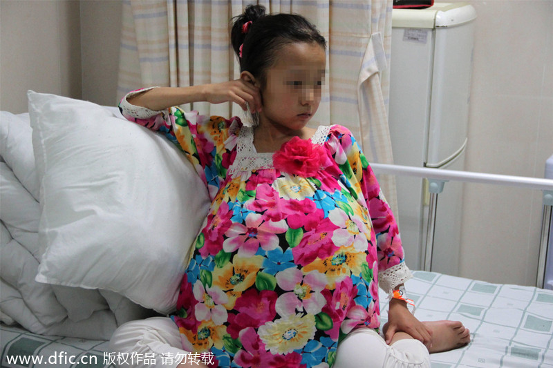 Guangzhou hospital offers hope to tumor girl