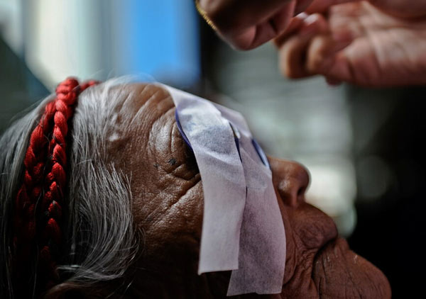 Cataract project benefits 30,000 blind Tibetans