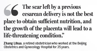 C-section is no longer cutting edge