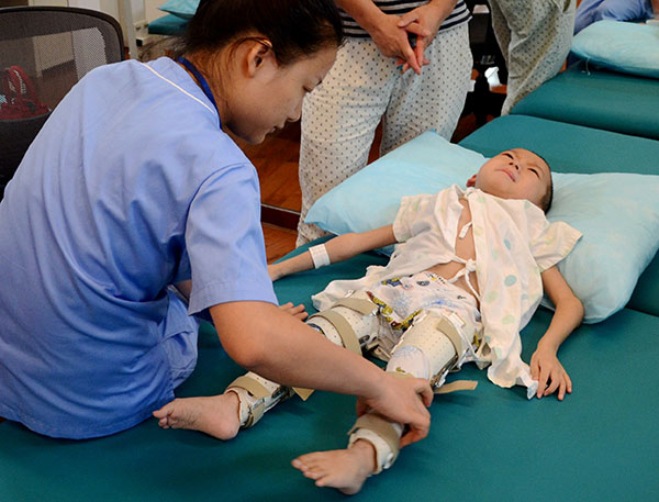 Surgeons use 3-D printing to help boy stand