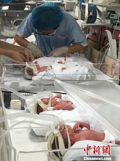 Identical natural quadruplets born in Shanghai: 1 in 13 million