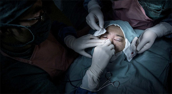 Chinese women spend big on beauty surgery