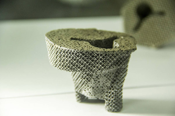 Knee repaired with world's 1st 3D-printed tantalum pad