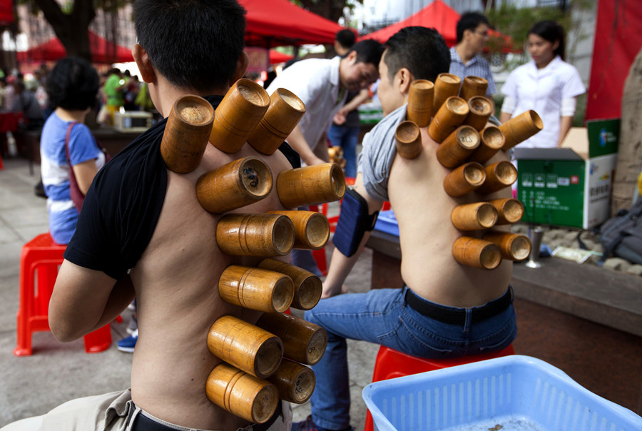 Une rencontre inattendue avec le « cupping » au coeur du quartier