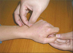 Home-grown healing power