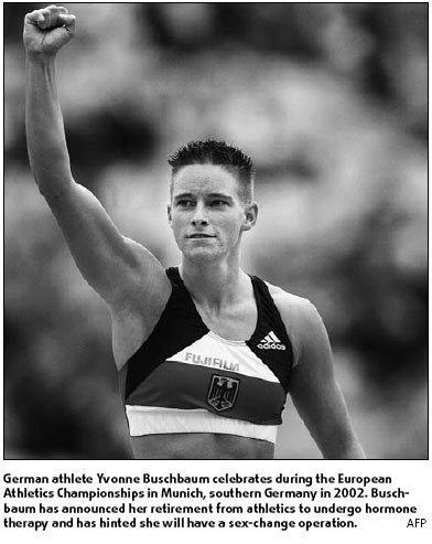 Buschbaum set to quit for sex-change op