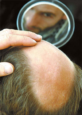 Toupee or not toupee