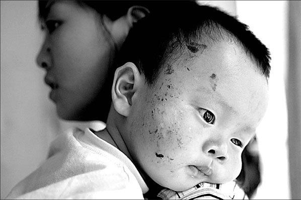 Intensive care for youngest victims