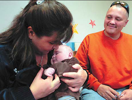 Tumor with foot removed from newborn's brain