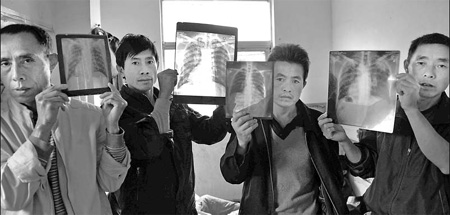 Lung disease worries workers