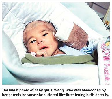 Baby's parents must agree to treatment