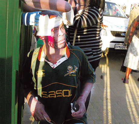 At least 15 hurt in stadium stampede