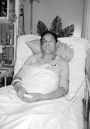 Terror victims recovering from mental trauma