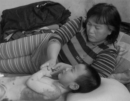 For boy, mom pushes past the pain barrier