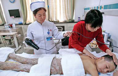 Young fire victim undergoing treatment