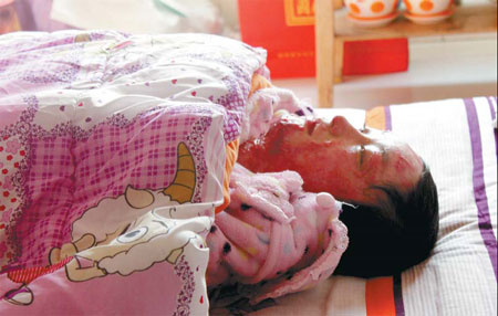 Attack victim's pain goes on