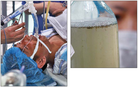 Miners get help in fight against disease