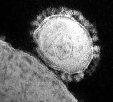 Death toll from Middle East virus rises