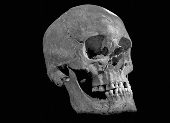 Bones suggest Richard III met swift death