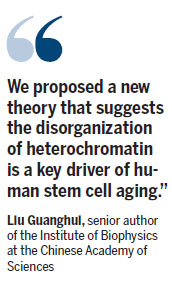 Scientists identify possible driver of aging progression