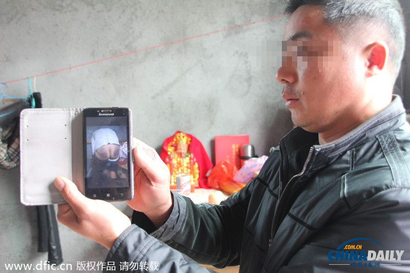 浙江义乌：10岁学生没做作业被女老师用教鞭抽 屁股一片黑紫