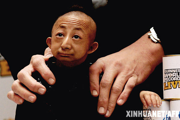 前吉尼斯世界最矮纪录保持者何平平逝世