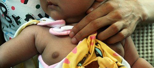 <em>外阴</em>充血等症状