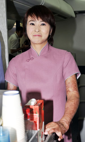 台湾女孩遭烧伤从容生活 华航助圆“空姐梦”