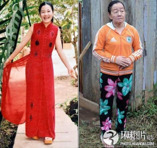 难以置信的罕见怪病:忘记呼吸 静电过敏 听闹钟响心脏停跳