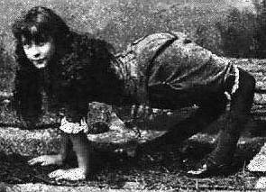 人类历史上九大怪胎：四腿女人和“独角兽”