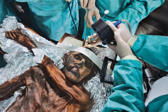 冰封5300年的神秘冰人木乃伊什么样？(组图)