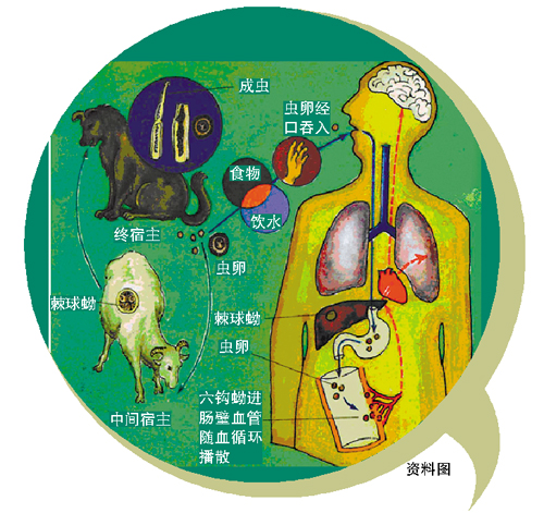 少女和宠物睡觉多年 遭虫噬空骨头瘫痪在床