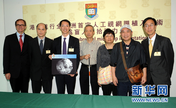 港大成功进行亚洲首例人工视网膜植入手术(图)