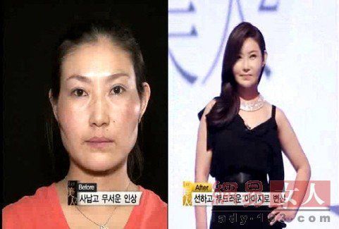 丑女变靓妹！韩国整容节目爆红