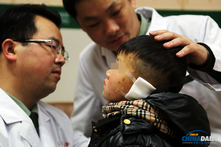 6岁男童惨遭婶婶割耳续：有医院免费为他造左耳