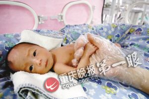 袖珍双胞胎姐妹悲喜两重天 放弃哪个都舍不得