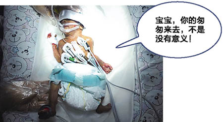 重庆“筷子宝宝”昨凌晨离世：我来过了 世界很温暖