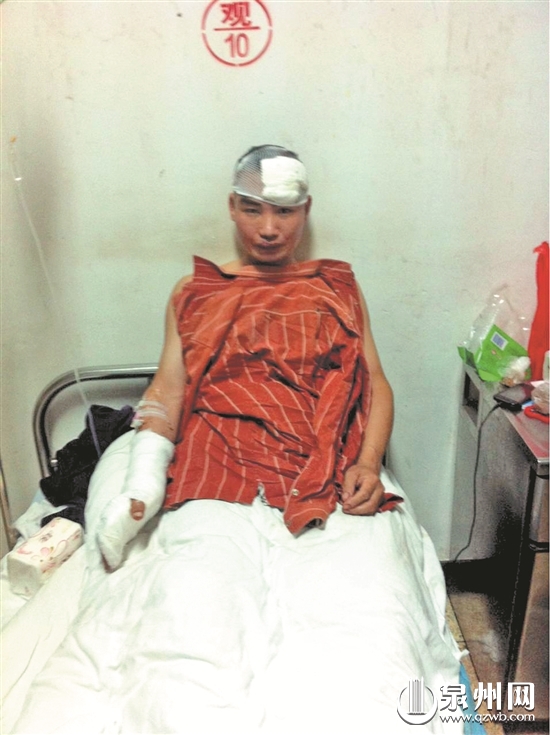 南安一男子在家遭抢被砍 歹徒离开前让他去医