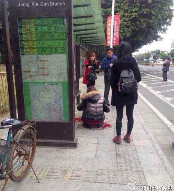 广东佛山一女子等车遇抢劫被砍10多刀 双手被砍烂