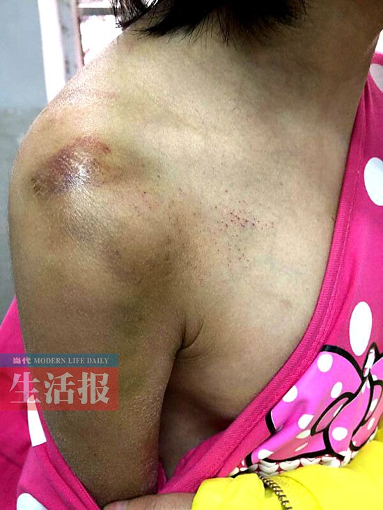 女童常常被“阿姨”殴打 连邻居都看不过眼了