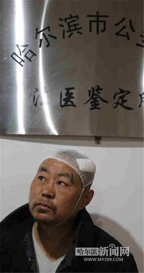 哈尔滨多名老板争相为受伤流浪哥提供工作(图)